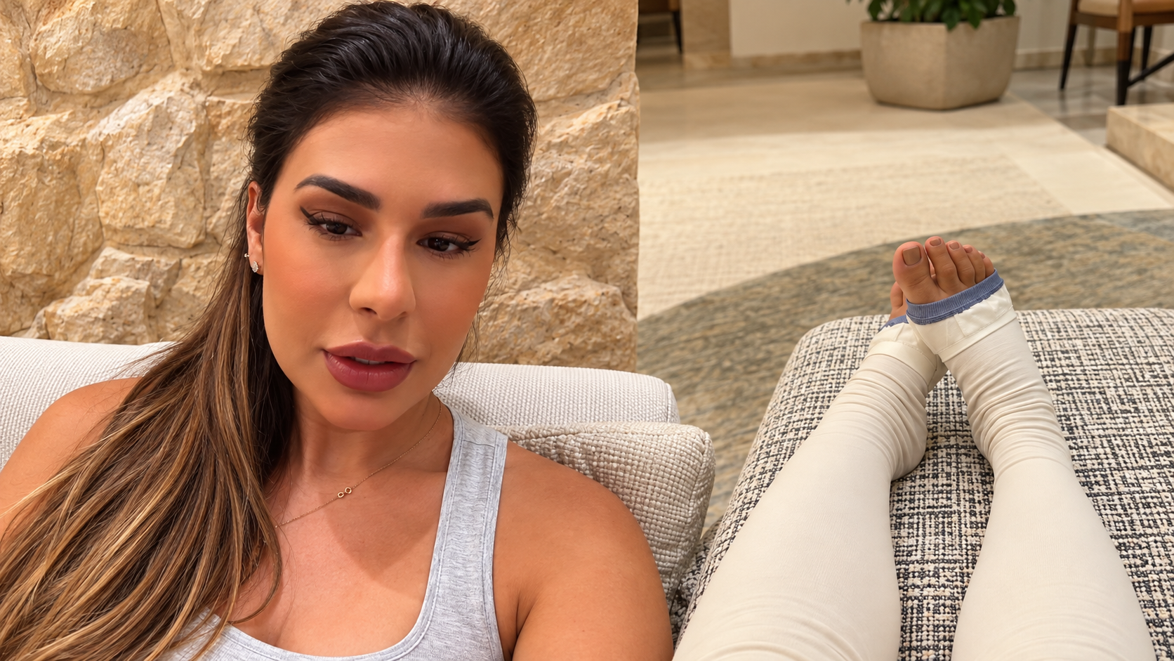 Simone Mendes faz cirurgia para retirar excesso de pele das coxas após perder mais de 30 kg